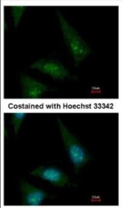 CLASP1 Antibody, Novus Biologicals 0.1mL; Unlabeled:Antibodies, Polyclonal