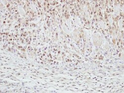 CLASP1 Antibody, Novus Biologicals 0.1mL; Unlabeled:Antibodies, Polyclonal
