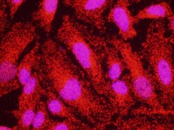 Claspin Antibody, Novus Biologicals 0.1mg; Unlabeled:Antibodies, Polyclonal