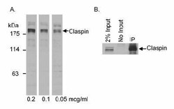 Claspin Antibody, Novus Biologicals 0.1mg; Unlabeled:Antibodies, Polyclonal