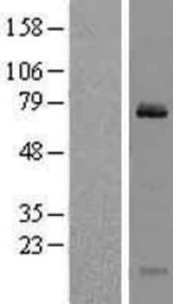 Novus Biologicals&trade;&nbsp;Clathrin interactor 1 Overexpression Lysate