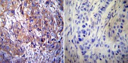 Clathrin Heavy Chain 1/CHC17 Antibody (X22) - BSA Free, Novus Biologicals