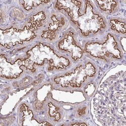 Clathrin light chain Antibody, Novus Biologicals:Antibodies:Primary Antibodies