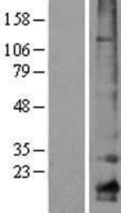 Novus Biologicals&trade;&nbsp;Claudin 10 Overexpression Lysate