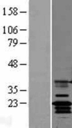 Novus Biologicals&trade;&nbsp;Claudin-14 Overexpression Lysate
