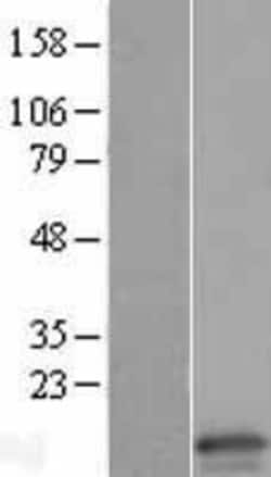Novus Biologicals&trade;&nbsp;Claudin-15 Overexpression Lysate
