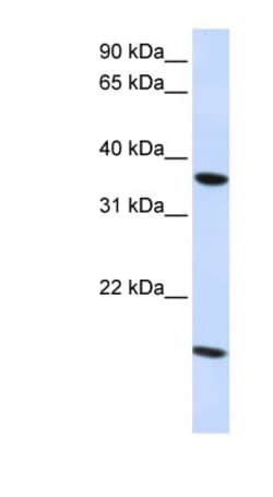 Claudin-16 Antibody, Novus Biologicals 100&mu;L; Unlabeled:Antibodies,