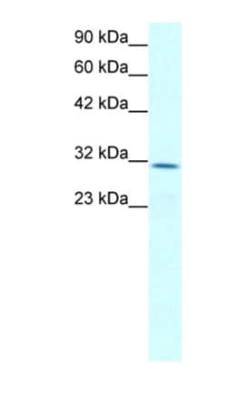 Claudin-17 Antibody, Novus Biologicals 0.1mg; Unlabeled:Antibodies, Polyclonal