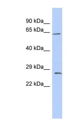 Claudin-18 Antibody, Novus Biologicals 100&mu;L; Unlabeled:Antibodies,