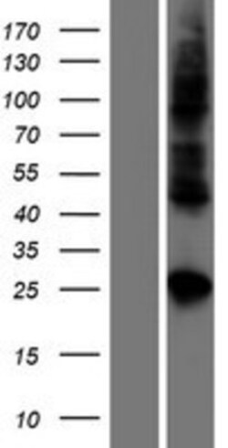 Novus Biologicals&trade;&nbsp;Claudin-19 Overexpression Lysate