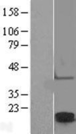 Novus Biologicals&trade;&nbsp;Claudin-2 Overexpression Lysate