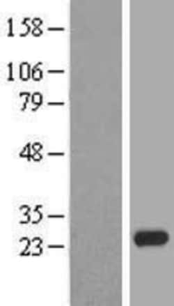 Novus Biologicals&trade;&nbsp;Claudin-20 Overexpression Lysate