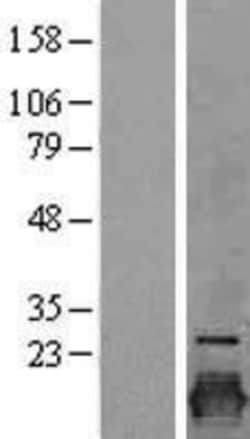 Novus Biologicals&trade;&nbsp;Claudin-3 Overexpression Lysate