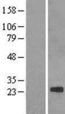Novus Biologicals&trade;&nbsp;Claudin-7 Overexpression Lysate