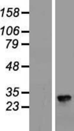 Novus Biologicals&trade;&nbsp;Claudin-8 Overexpression Lysate