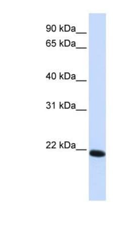 Claudin-19 Antibody, Novus Biologicals 0.05mg; Unlabeled:Antibodies, Polyclonal