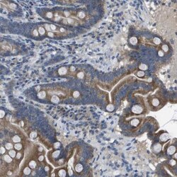 CLCA4 Antibody, Novus Biologicals 25 &mu;L; Unlabeled:Antibodies, Polyclonal