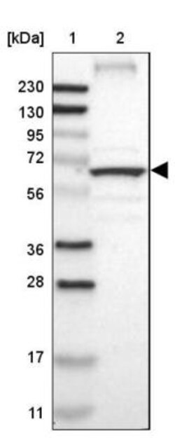 CLCC1 Antibody, Novus Biologicals 25 &mu;L; Unlabeled:Antibodies, Polyclonal
