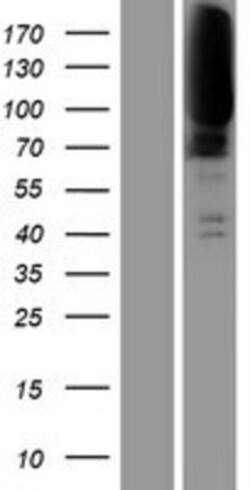 Novus Biologicals&trade;&nbsp;CLCN1 Overexpression Lysate