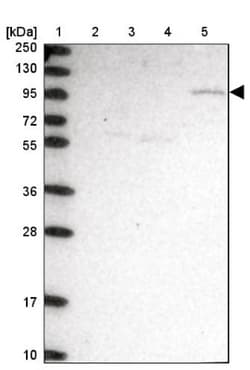 CLCN3 Antibody, Novus Biologicals 0.1mL; Unlabeled:Antibodies, Polyclonal