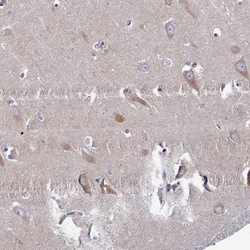 CLCN3 Antibody, Novus Biologicals 0.1mL; Unlabeled:Antibodies, Polyclonal