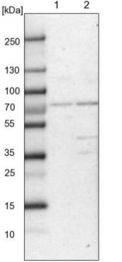 CLCN3 Antibody, Novus Biologicals 0.1mL; Unlabeled:Antibodies, Polyclonal