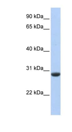 CLDND1 Antibody, Novus Biologicals 100&mu;L; Unlabeled:Antibodies, Polyclonal