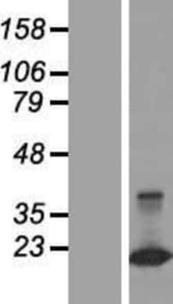 Novus Biologicals&trade;&nbsp;CLDND2 Overexpression Lysate