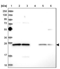 CLE7 homolog Antibody, Novus Biologicals 0.1mL; Unlabeled:Antibodies, Polyclonal