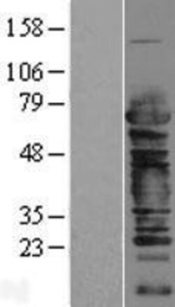 Novus Biologicals&trade;&nbsp;Cleavage stimulation factor 2 Overexpression Lysate