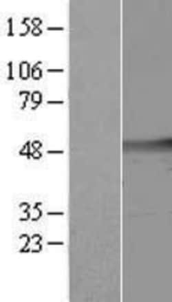 Novus Biologicals&trade;&nbsp;cleavage stimulation factor Overexpression Lysate