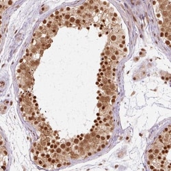cleavage stimulation factor Antibody, Novus Biologicals:Antibodies:Primary
