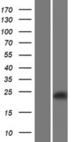Novus Biologicals&trade;&nbsp;OCIL/CLEC2d Overexpression Lysate