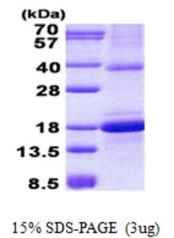 Novus Biologicals&trade;&nbsp;Recombinant Human OCIL/CLEC2d His Protein