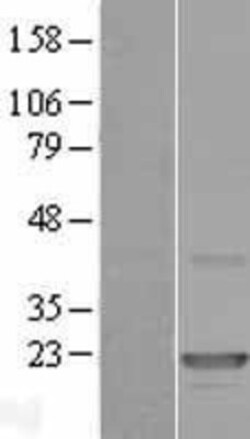 Novus Biologicals&trade;&nbsp;CLEC3A Overexpression Lysate