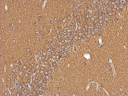 DCIR/CLEC4A Antibody, Novus Biologicals 0.1mL; Unlabeled:Antibodies, Polyclonal