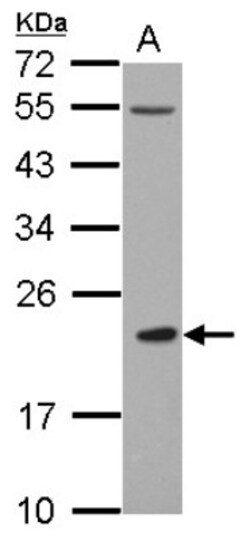 DCIR/CLEC4A Antibody, Novus Biologicals 0.1mL; Unlabeled:Antibodies, Polyclonal
