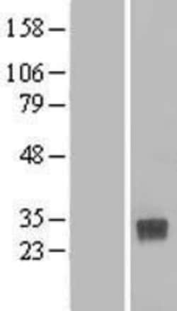 Novus Biologicals&trade;&nbsp;CLEC4D/CLECSF8 Overexpression Lysate