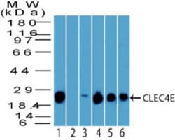 CLEC4E Antibody, Novus Biologicals:Antibodies:Primary Antibodies