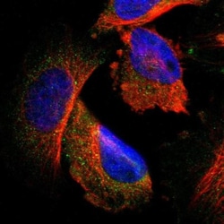 CLEC4E Antibody, Novus Biologicals 25 &mu;L, Unlabeled:Antibodies, Polyclonal