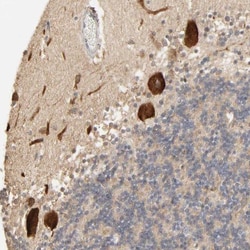 CLEC4E Antibody, Novus Biologicals 25 &mu;L, Unlabeled:Antibodies, Polyclonal