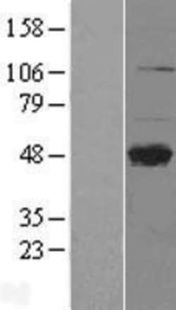 Novus Biologicals&trade;&nbsp;DC-SIGNR/CD299/CLEC4M Overexpression Lysate