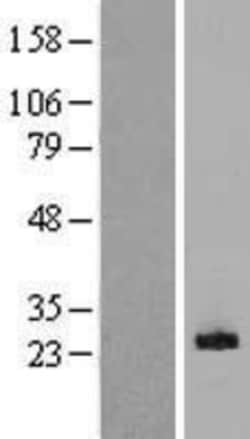 Novus Biologicals&trade;&nbsp;MDL-1/CLEC5A Overexpression Lysate