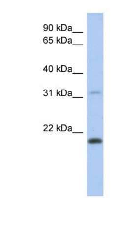 CLECL1 Antibody, Novus Biologicals 100&mu;L; Unlabeled:Antibodies, Polyclonal