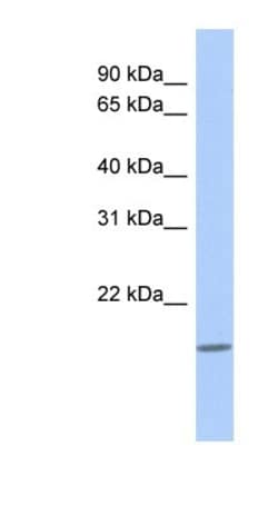 CLECL1 Antibody, Novus Biologicals 100 &mu;L | Buy Online | Novus Biologicals | Fisher Scientific