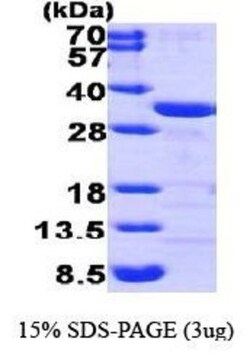 Novus Biologicals&trade;&nbsp;Recombinant Human CLIC1 His Protein