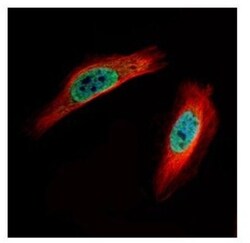 CLIC4 Antibody, Novus Biologicals 0.1mg; Unlabeled:Antibodies, Polyclonal