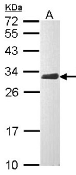 CLIC4 Antibody, Novus Biologicals 0.1mg; Unlabeled:Antibodies, Polyclonal