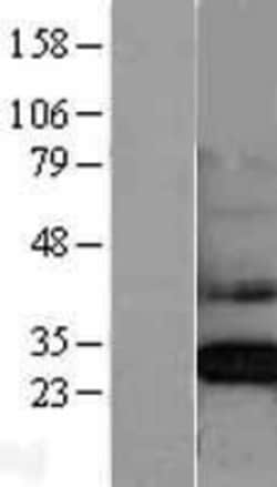 Novus Biologicals&trade;&nbsp;CLIC4 Overexpression Lysate