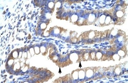 CLIC5 Antibody, Novus Biologicals 0.1mg; Unlabeled:Antibodies, Polyclonal